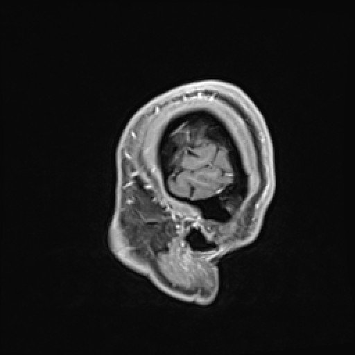 Click on the Serie image to view the images of VILLANUEVA, WILLIAM A.